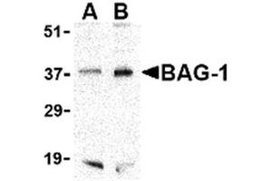Image no. 1 for anti-BCL2-Associated Athanogene (BAG1) (C-Term) antibody (ABIN318738)