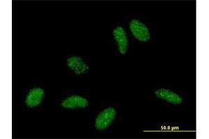 Immunofluorescence of purified MaxPab antibody to RBBP6 on HeLa cell. (RBBP6 抗体  (AA 1-118))