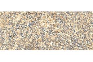 Immunohistochemistry of paraffin-embedded Human tonsil tissue using NTAN1 Polyclonal Antibody at dilution of 1:50(x200) (NTAN1 抗体)