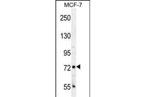 CTGE4 Antibody (N-term) (ABIN655781 and ABIN2845216) western blot analysis in MCF-7 cell line lysates (35 μg/lane). (CTAGE4 抗体  (N-Term))