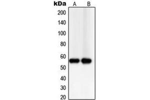 Western blot analysis of TXNRD2 expression in PC12 (A), Jurkat (B) whole cell lysates. (TXNRD2 抗体  (C-Term))
