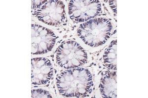 (ABIN6242434 and ABIN6577257) staining MBD2 in human colon tissue sections by Immunohistochemistry (IHC-P - paraformaldehyde-fixed, paraffin-embedded sections). (MBD2 抗体  (AA 10-228))
