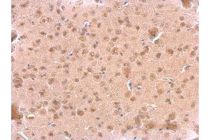 IHC-P Image ARF3 antibody detects ARF3 protein at cytosol on mouse fore brain by immunohistochemical analysis. (ARF3 抗体)