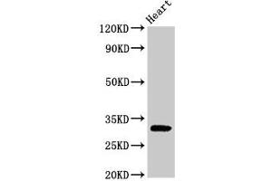 Western Blot Positive WB detected in: Rat heart tissue All lanes: PPP1R3B antibody at 2. (PPP1R3B 抗体  (Regulatory Subunit 3B))