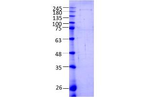 SDS-PAGE (SDS) image for Ataxin 2 (ATXN2) (AA 1-1313) protein (ABIN3089810)