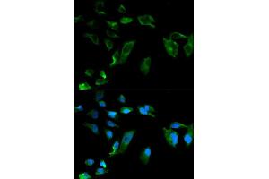 Immunofluorescence analysis of HeLa cell using NEK8 antibody. (NEK8 抗体  (AA 1-300))