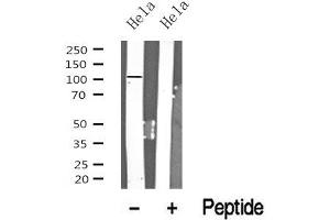 Western blot analysis of PRK1/2 in lysates of Hela? (PRK1/2 抗体)