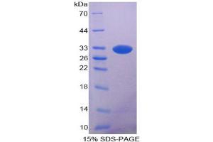 SDS-PAGE analysis of Rat Lipase, Pancreatic Protein. (Lipase 蛋白)
