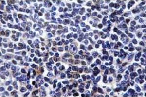 Immunohistochemistry (IHC) analyzes of p-Paxillin (pTyr31) antibody in paraffin-embedded human tonsil tissue. (Paxillin 抗体  (pTyr31))