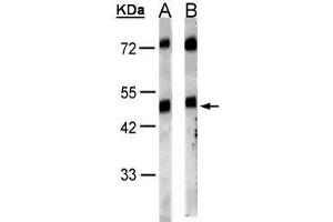 WB Image Sample(30 μg of whole cell lysate) A:HeLa S3, B:MOLT4, 10% SDS PAGE antibody diluted at 1:1000 (GRPR 抗体)