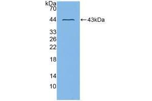 Western blot analysis of recombinant Mouse ADAM8. (ADAM8 抗体  (AA 145-493))