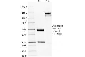 SDS-PAGE (SDS) image for anti-Spectrin, Beta, Non-erythrocytic 2 (SPTBN2) (AA 356-475) antibody (ABIN6940651)