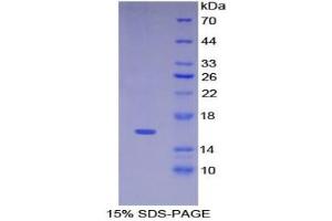 SDS-PAGE of Protein Standard from the Kit (Highly purified E. (KRT15 ELISA 试剂盒)
