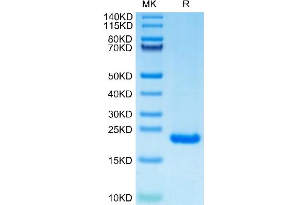 PTP4A2 Protein (AA 1-164) (His tag)