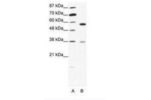 Image no. 1 for anti-GDP Dissociation Inhibitor 1 (GDI1) (C-Term) antibody (ABIN202545) (GDI1 抗体  (C-Term))