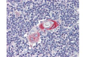 Anti-CPXCR1 antibody IHC staining of human thymus. (CPXCR1 抗体  (Middle Region))