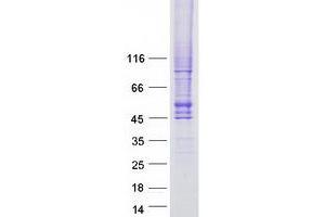 Western Blotting (WB) image for Solute Carrier Family 2 (Facilitated Glucose Transporter), Member 4 (SLC2A4) protein (Myc-DYKDDDDK Tag) (ABIN2721983)