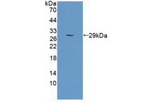 Western Blotting (WB) image for anti-Sema Domain, Seven Thrombospondin Repeats (Type 1 and Type 1-Like), Transmembrane Domain (TM) and Short Cytoplasmic Domain, (Semaphorin) 5B (SEMA5B) (AA 350-602) antibody (ABIN7426943)