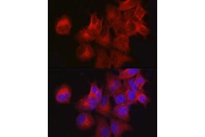 Immunofluorescence analysis of MCF7 cells using CDKN3 Rabbit pAb (ABIN3022821, ABIN3022822, ABIN3022823, ABIN1512750 and ABIN6219244) at dilution of 1:100 (40x lens). (CDKN3 抗体  (AA 1-172))