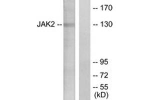 Western blot analysis of extracts from HT-29 cells, using JAK2 (Ab-1007) Antibody. (JAK2 抗体  (AA 981-1030))