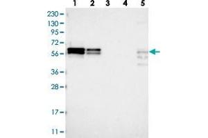 Western blot analysis of Lane 1: RT-4, Lane 2: U-251 MG, Lane 3: Human Plasma, Lane 4: Liver, Lane 5: Tonsil with ZC3H15 polyclonal antibody .