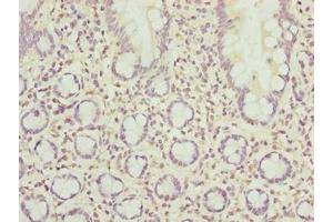 Immunohistochemistry of paraffin-embedded human small intestine tissue using ABIN7168517 at dilution of 1:100 (SCAPER 抗体  (AA 1109-1400))