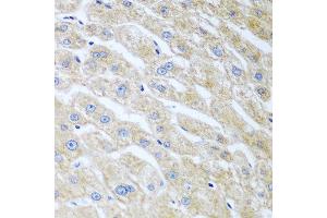 Immunohistochemistry of paraffin-embedded human liver using UCHL3 antibody at dilution of 1:100 (40x lens). (UCHL3 抗体)