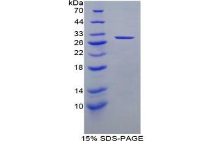 SDS-PAGE analysis of Rat DLD Protein. (DLD 蛋白)