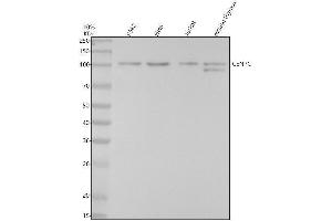 anti-Centromere Protein C Pseudogene 1 (CENPCP1) antibody