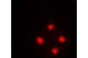 Immunofluorescent analysis of SRSF5 staining in HeLa cells. (SRSF5 抗体)