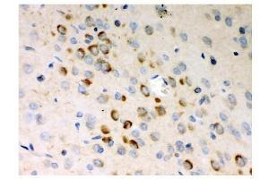 IHC analysis of Stathmin 1 using anti-Stathmin 1 antibody (ABIN3043301). (Stathmin 1 抗体  (N-Term))
