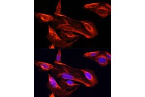 Immunofluorescence analysis of U2OS cells using MMP2 antibody (ABIN6129300, ABIN6143910, ABIN6143912 and ABIN6215078) at dilution of 1:100. (MMP2 抗体  (AA 40-280))