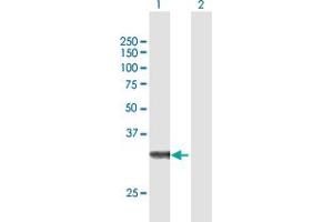Western Blot analysis of ZFAND3 expression in transfected 293T cell line by ZFAND3 MaxPab polyclonal antibody. (ZFAND3 抗体  (AA 1-227))
