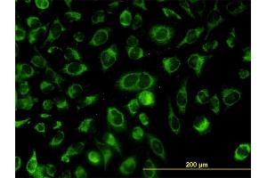 Immunofluorescence of monoclonal antibody to ACOT9 on HeLa cell. (ACOT9 抗体  (AA 1-212))