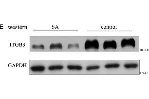 The expressions of H19 and integrin β3 (ITGB3) decrease in human embryonic chorion tissue of spontaneous abortion. (GAPDH 抗体)