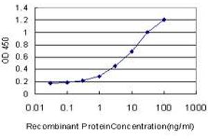 Detection limit for recombinant GST tagged ALDH2 is approximately 0. (ALDH2 抗体  (AA 408-517))