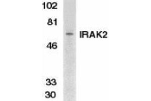 Western blot analysis of IRAK2 in K562 whole cell lysate with AP30441PU-N IRAK2 antibody at 1/500 dilution. (IRAK2 抗体  (C-Term))