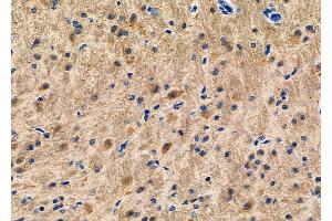ABIN6263544 and ABIN6266651 at 1/100 staining Mouse brain tissue by IHC-P. (NCOR1 抗体  (N-Term))