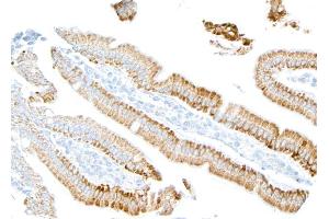Immunohistochemistry (IHC) image for anti-Mitochondrial Calcium Uniporter (MCU) (AA 300-350) antibody (ABIN7795789)