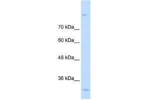 WB Suggested Anti-MPPED2 Antibody Titration:  0. (MPPED2 抗体  (C-Term))