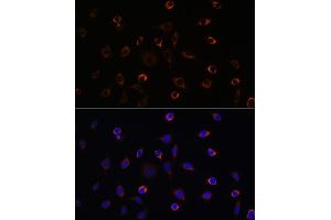 Immunofluorescence (IF) image for anti-Kinesin Family Member 5B (KIF5B) (AA 650-770) antibody (ABIN7268136)