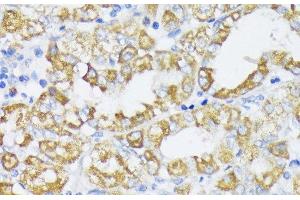 Immunohistochemistry of paraffin-embedded Human stomach using SLC30A1 Polyclonal Antibody at dilution of 1:100 (40x lens). (SLC30A1 抗体)