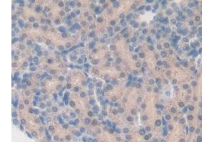 DAB staining on IHC-P; Samples: Rat Kidney Tissue (CYP27B1 抗体  (AA 251-500))