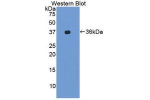 Western Blotting (WB) image for anti-Integrin alpha-L (ITGAL) (AA 809-1066) antibody (ABIN1859650) (ITGAL 抗体  (AA 809-1066))