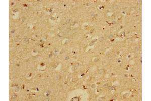 Immunohistochemistry of paraffin-embedded human brain tissue using ABIN7163532 at dilution of 1:100 (PAI1 抗体  (AA 24-398))