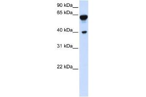 DTNB antibody used at 1 ug/ml to detect target protein. (Dystrobrevin beta 抗体  (C-Term))