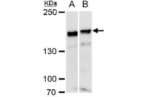 WB Image ROCK1 antibody [N1N2], N-term detects ROCK1 protein by western blot analysis. (ROCK1 抗体  (N-Term))