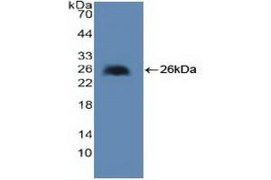 Western blot analysis of recombinant Human cPLA2. (PLA2G4A 抗体  (AA 1-178))