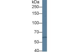 Western Blot; Sample: Human Hela cell lysate; Primary Ab: 1µg/ml Rabbit Anti-Human PKD3 Antibody Second Ab: 0. (PRKD3 抗体  (AA 576-832))