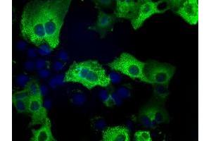 Image no. 1 for anti-Transforming, Acidic Coiled-Coil Containing Protein 3 (TACC3) antibody (ABIN1498100) (TACC3 抗体)